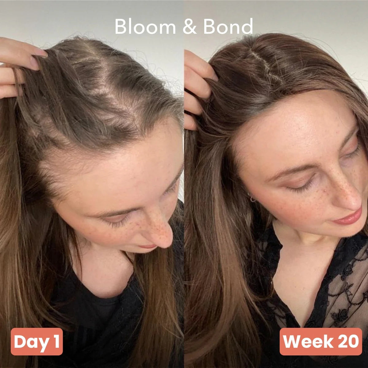 Pumphera Pumpkin Hair Growth Gels