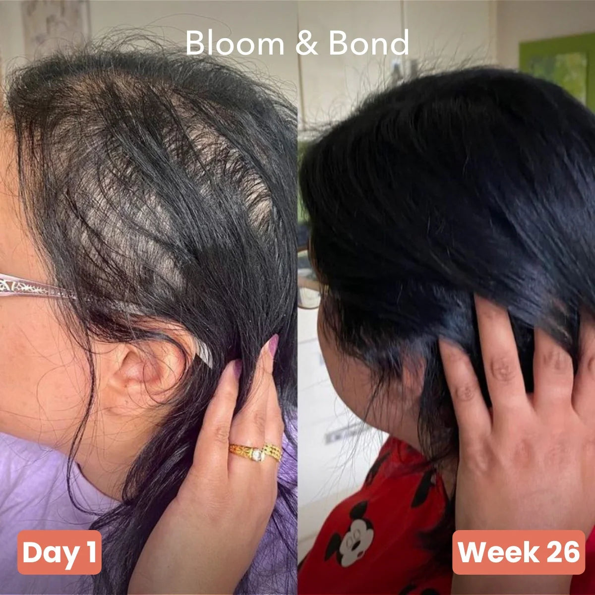 Pumphera Pumpkin Hair Growth Gels