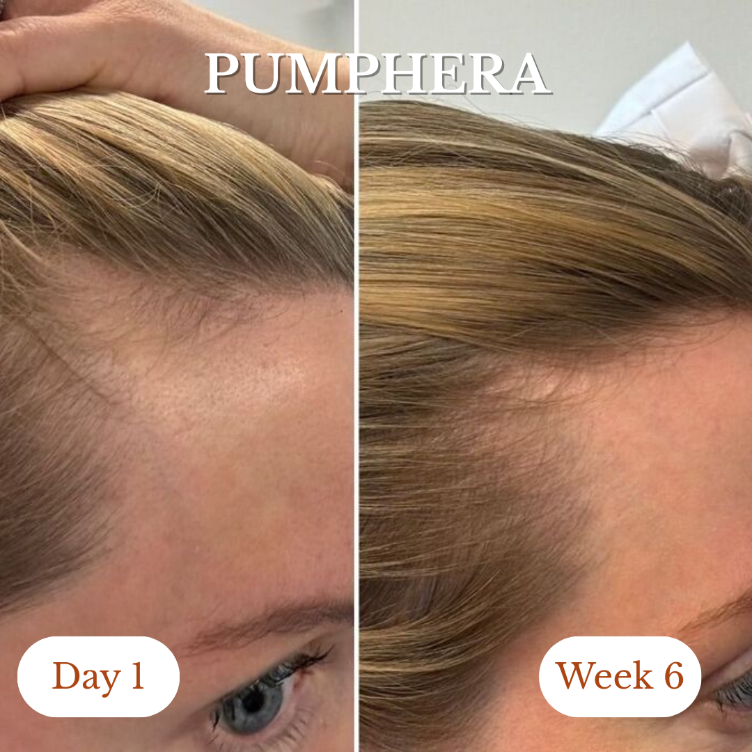 Pumphera Pumpkin Hair Growth Gels
