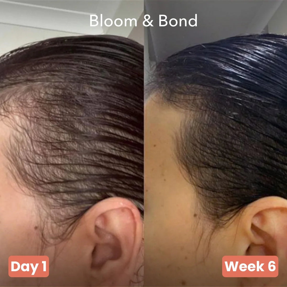 Pumphera Pumpkin Hair Growth Gels