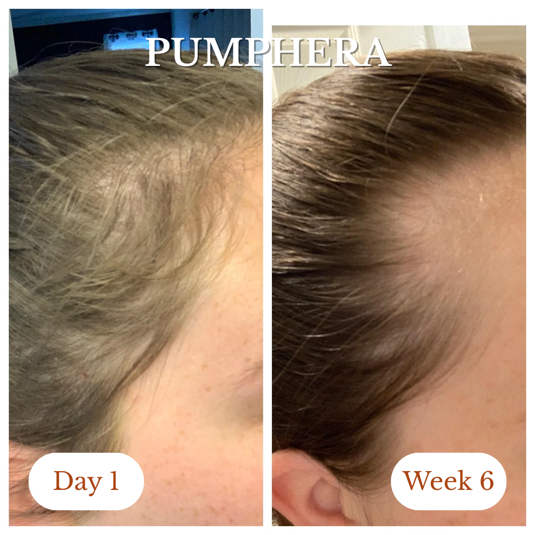 Pumphera Pumpkin Hair Growth Gels